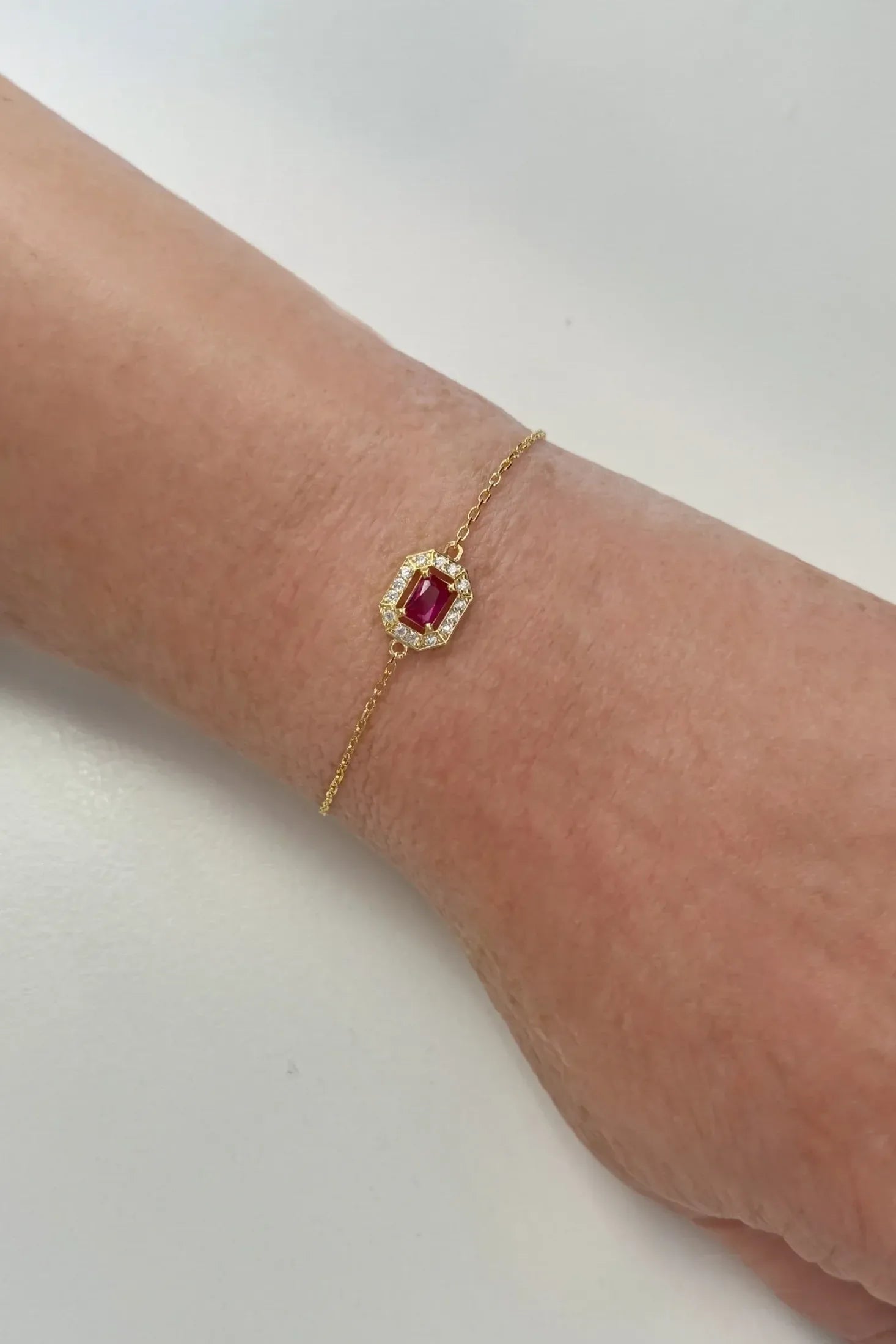 The bracelet on an arm.